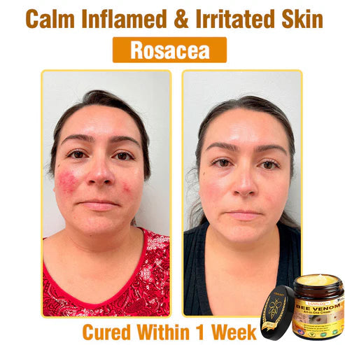 Advanced Bio-Active Rejuvenating Lift Cream