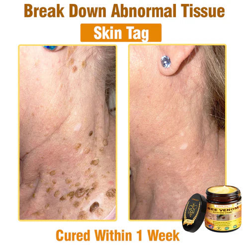 Advanced Bio-Active Rejuvenating Lift Cream