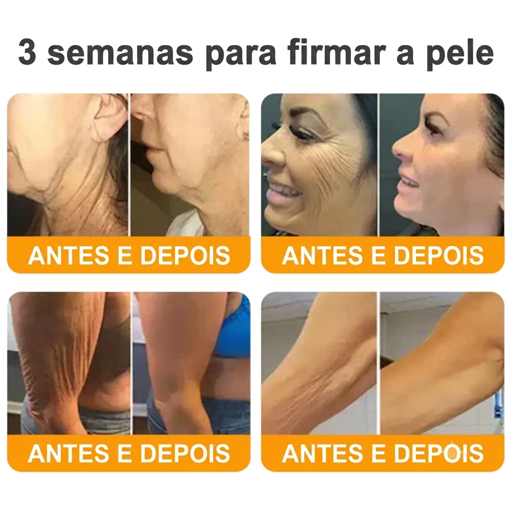 Creme 𝐁𝐞𝐞 𝐕𝐞𝐧𝐨𝐦 - 💥 Compre 1 e Leve mais 2 — Só Hoje