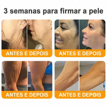 Creme 𝐁𝐞𝐞 𝐕𝐞𝐧𝐨𝐦 - 💥 Compre 1 e Leve mais 2 — Só Hoje
