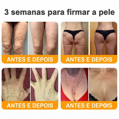 Creme 𝐁𝐞𝐞 𝐕𝐞𝐧𝐨𝐦 - 💥 Compre 1 e Leve mais 2 — Só Hoje